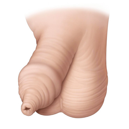Εικ. 1: Φίμωση Image